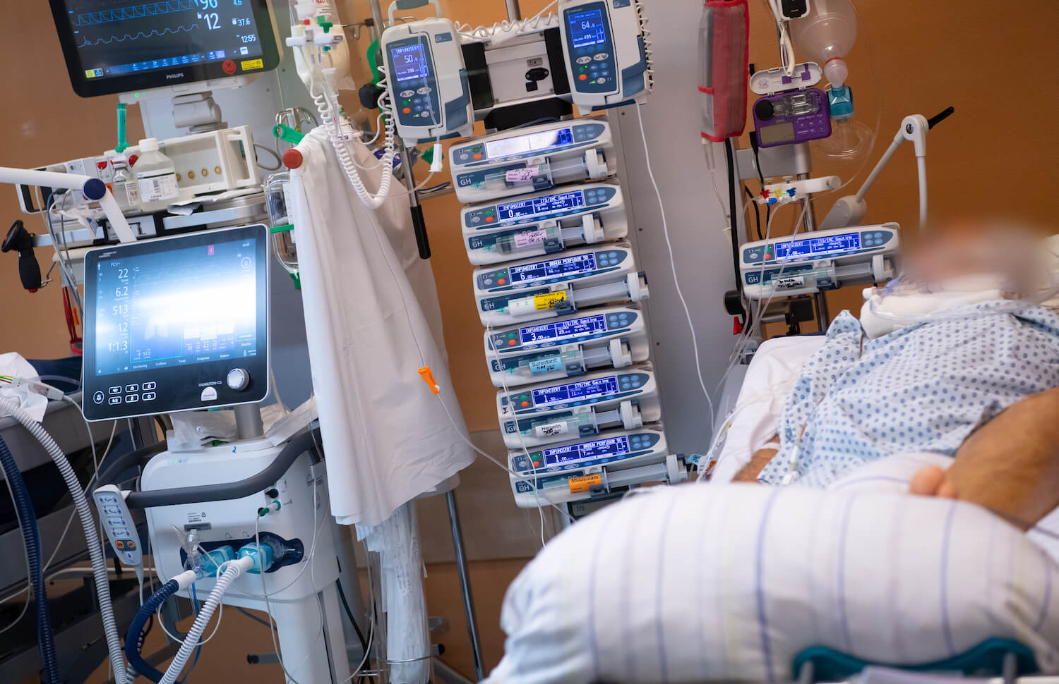 Ein Patient in einem Intensivbett