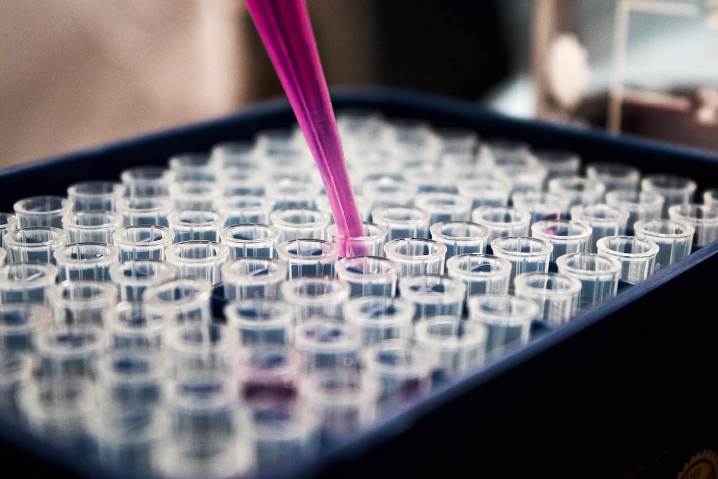 Eine pinke Pipette und mehrere Reagenzgläser in einer schwarzen Schale